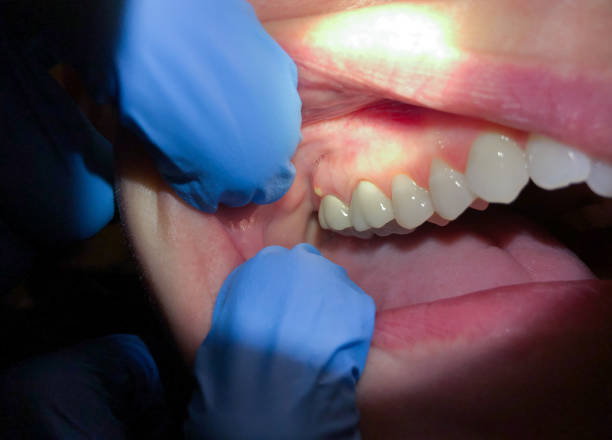 Best Emergency Orthodontic Repairs in Valley Falls, RI